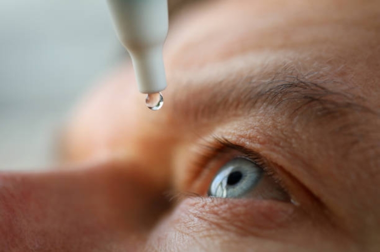 Glaucoma Treatment-------19