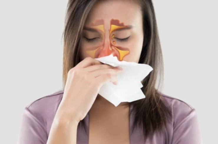 Sinus Treatment