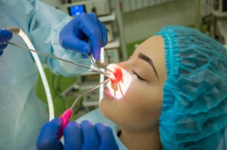 Advanced endoscopic sinus surgery--------19