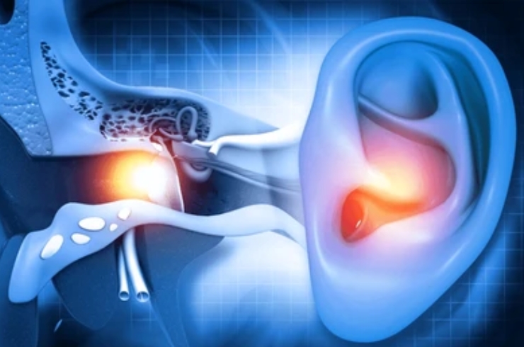 Ear Infections